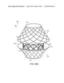 PROSTHETIC HEART VALVE DEVICES, PROSTHETIC MITRAL VALVES AND ASSOCIATED     SYSTEMS AND METHODS diagram and image