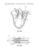 PROSTHETIC HEART VALVE DEVICES, PROSTHETIC MITRAL VALVES AND ASSOCIATED     SYSTEMS AND METHODS diagram and image