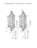 PROSTHETIC HEART VALVE DEVICES, PROSTHETIC MITRAL VALVES AND ASSOCIATED     SYSTEMS AND METHODS diagram and image