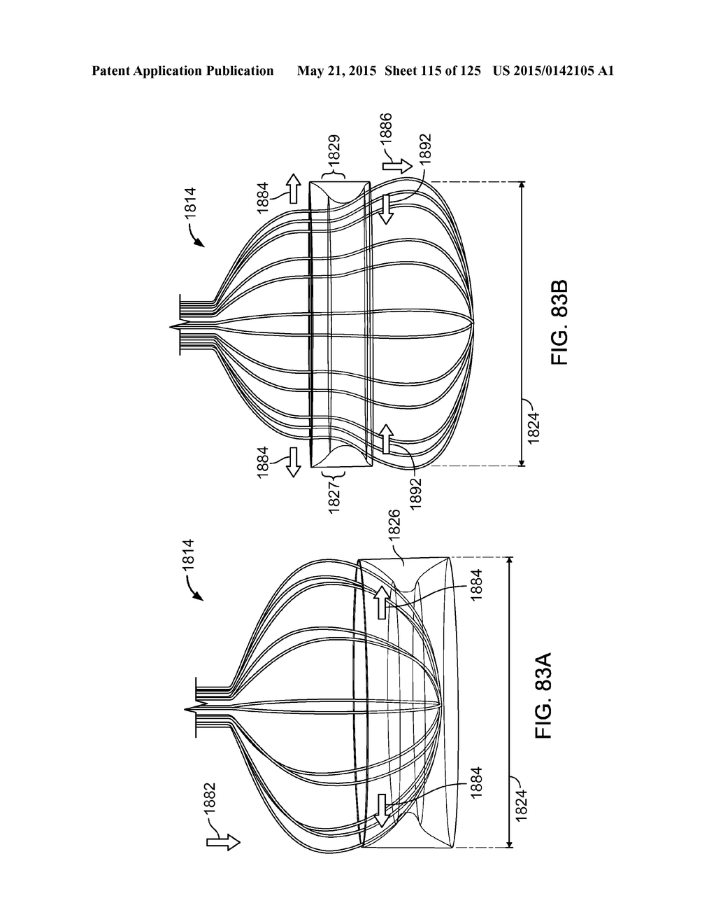 RECONFIGURING TISSUE FEATURES OF A HEART ANNULUS - diagram, schematic, and image 116