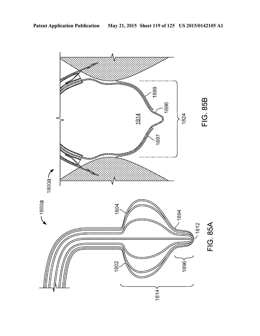 RECONFIGURING TISSUE FEATURES OF A HEART ANNULUS - diagram, schematic, and image 120