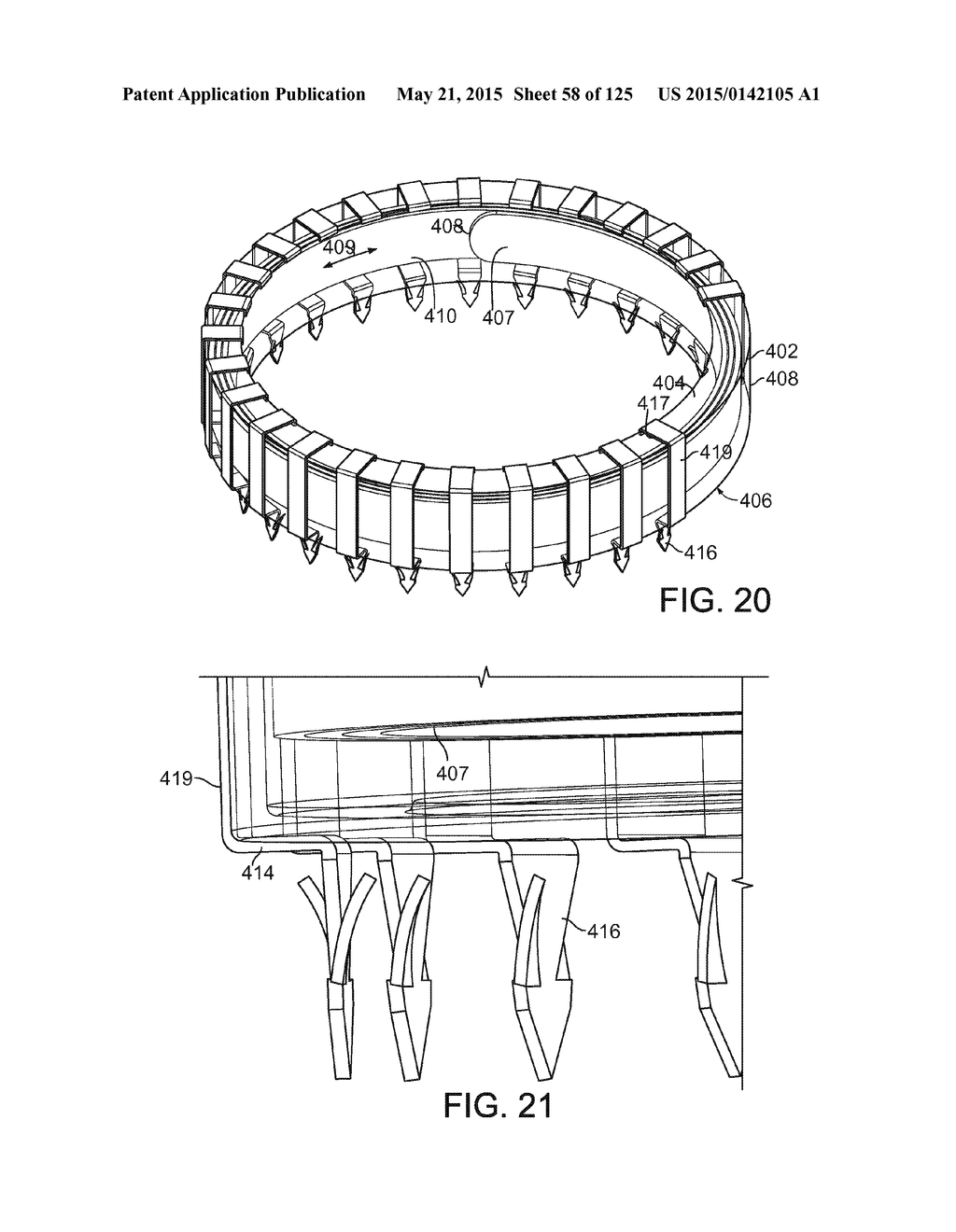 RECONFIGURING TISSUE FEATURES OF A HEART ANNULUS - diagram, schematic, and image 59