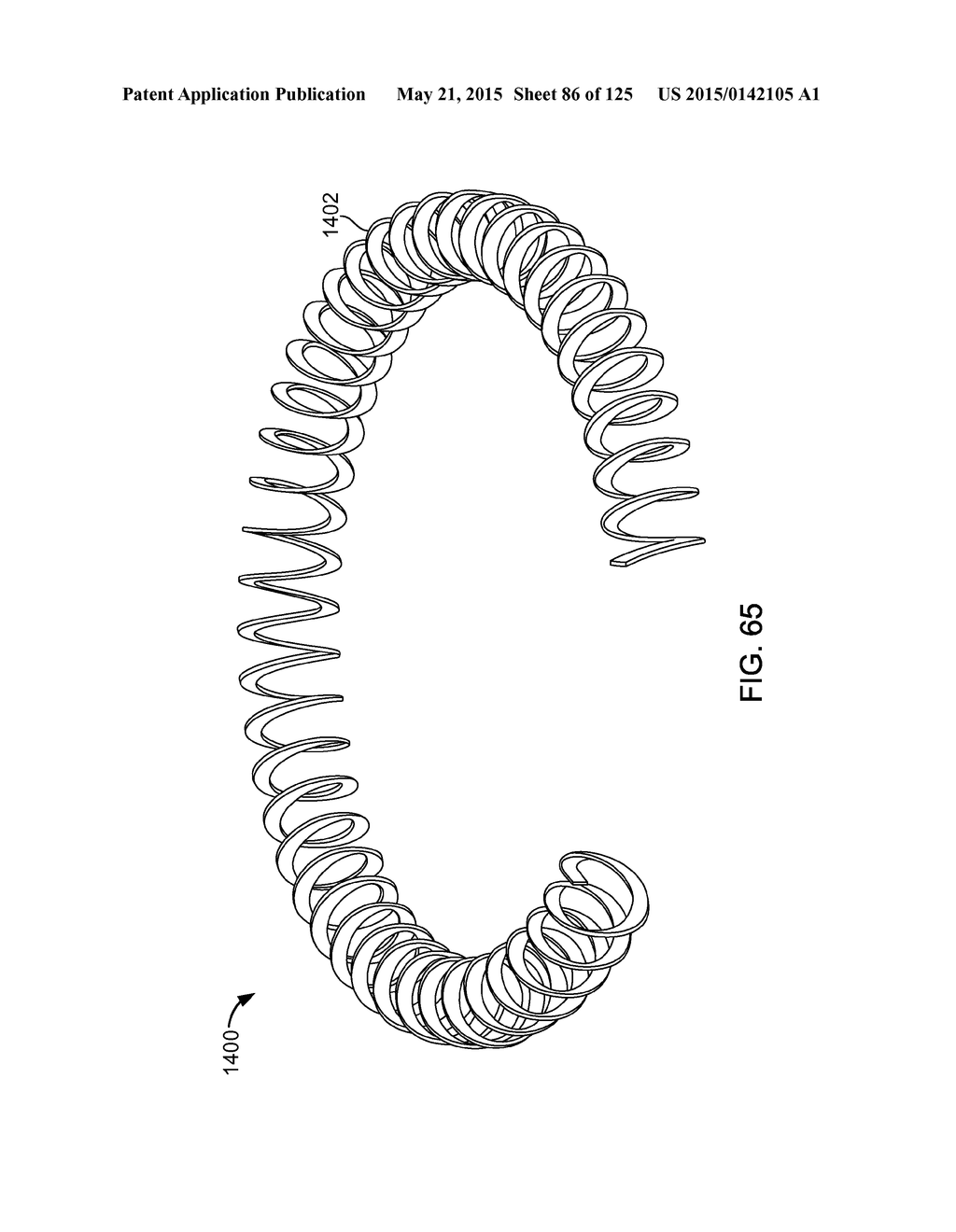 RECONFIGURING TISSUE FEATURES OF A HEART ANNULUS - diagram, schematic, and image 87