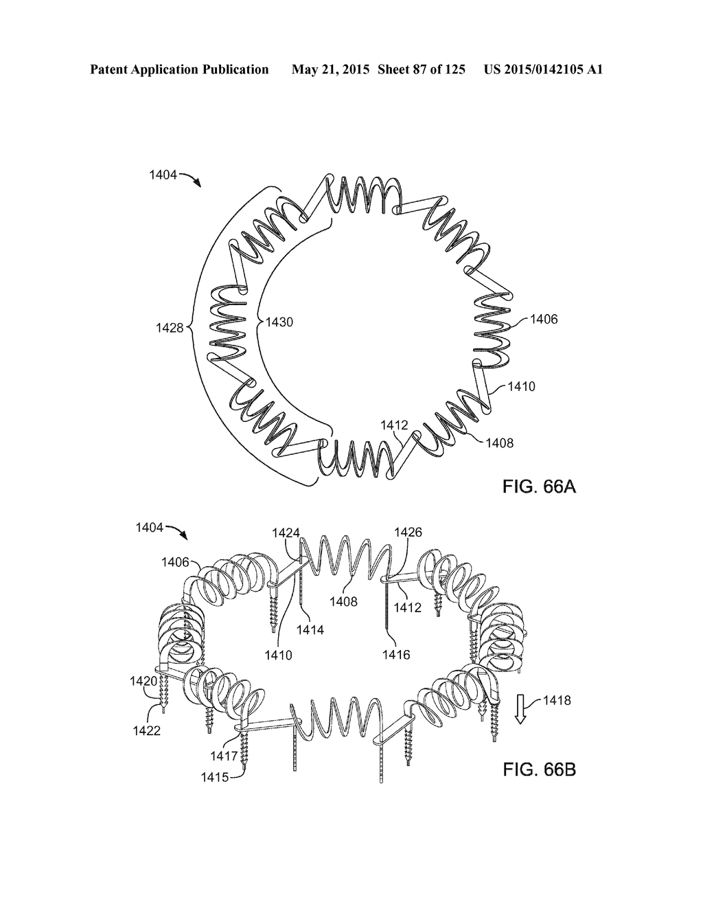 RECONFIGURING TISSUE FEATURES OF A HEART ANNULUS - diagram, schematic, and image 88