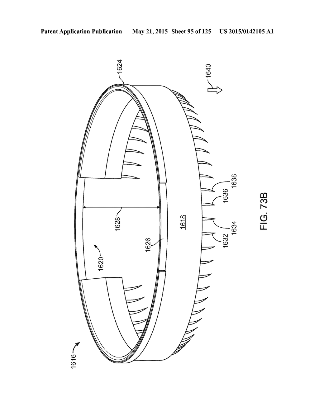 RECONFIGURING TISSUE FEATURES OF A HEART ANNULUS - diagram, schematic, and image 96