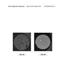Bone Cements Containing Magnetic Calcium Phosphate Nanoparticles diagram and image