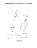 METHOD OF DIGITALLY CONSTRUCTING A PROSTHESIS diagram and image