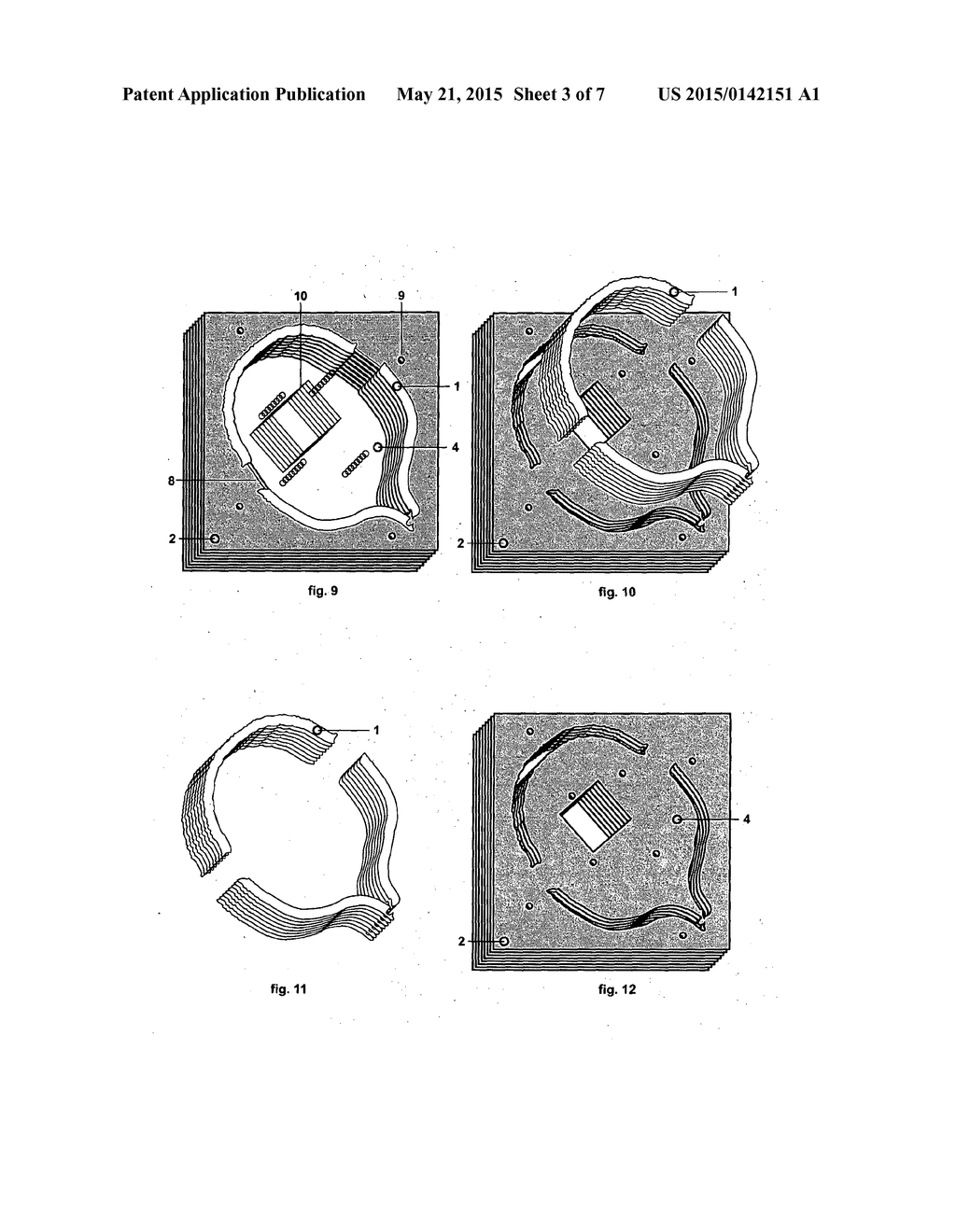 METHOD FOR TRANSFORMING A THREE DIMENSIONAL DIGITAL MODEL IN A SPACE     OBJECT MADE OF SHEET MATERIAL - diagram, schematic, and image 04