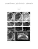 Methods and Compositions for Preparing Biological Specimens for     Microscopic Analysis diagram and image