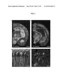 Methods and Compositions for Preparing Biological Specimens for     Microscopic Analysis diagram and image