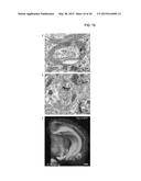 Methods and Compositions for Preparing Biological Specimens for     Microscopic Analysis diagram and image