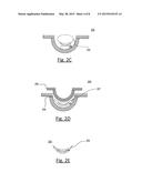 METHOD OF MANUFACTURING HYDROGEL OPHTHALMIC DEVICES WITH ELECTRONIC     ELEMENTS diagram and image