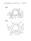 Axle Attachment diagram and image