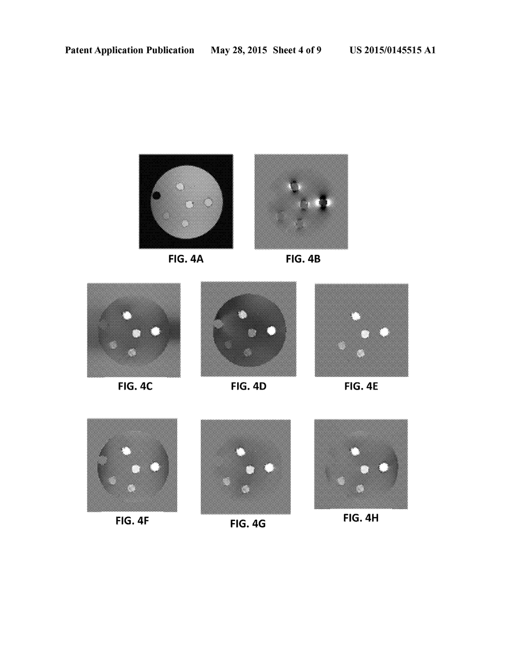 DIFFERENTIAL APPROACH TO QUANTITATIVE SUSCEPTIBILITY MAPPING WITHOUT     BACKGROUND FIELD REMOVAL - diagram, schematic, and image 05