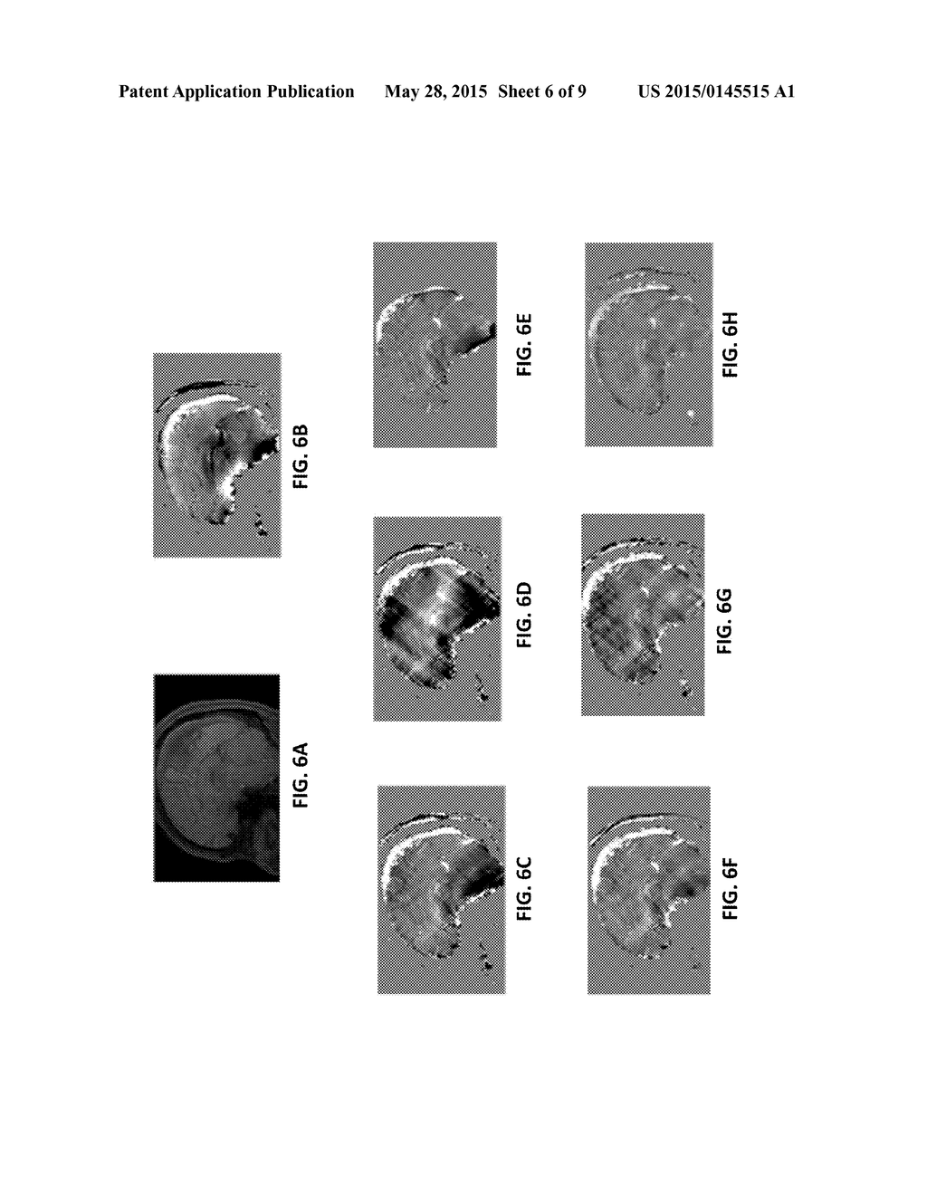 DIFFERENTIAL APPROACH TO QUANTITATIVE SUSCEPTIBILITY MAPPING WITHOUT     BACKGROUND FIELD REMOVAL - diagram, schematic, and image 07