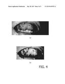 ELECTRONIC ENDOSCOPE DEVICE diagram and image