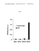 HIGH-AFFINITY MONOCLONAL ANTIBODIES TO GLYPICAN-3 AND USE THEREOF diagram and image