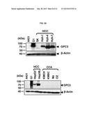 HIGH-AFFINITY MONOCLONAL ANTIBODIES TO GLYPICAN-3 AND USE THEREOF diagram and image