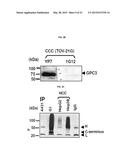 HIGH-AFFINITY MONOCLONAL ANTIBODIES TO GLYPICAN-3 AND USE THEREOF diagram and image