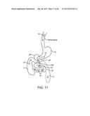 THERAPEUTIC AGENT PREPARATIONS FOR DELIVERY INTO A LUMEN OF THE INTESTINAL     TRACT USING A SWALLOWABLE DRUG DELIVERY DEVICE diagram and image