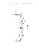 THERAPEUTIC AGENT PREPARATIONS FOR DELIVERY INTO A LUMEN OF THE INTESTINAL     TRACT USING A SWALLOWABLE DRUG DELIVERY DEVICE diagram and image