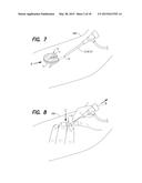 HEMOSTATIC DEVICE AND METHOD diagram and image