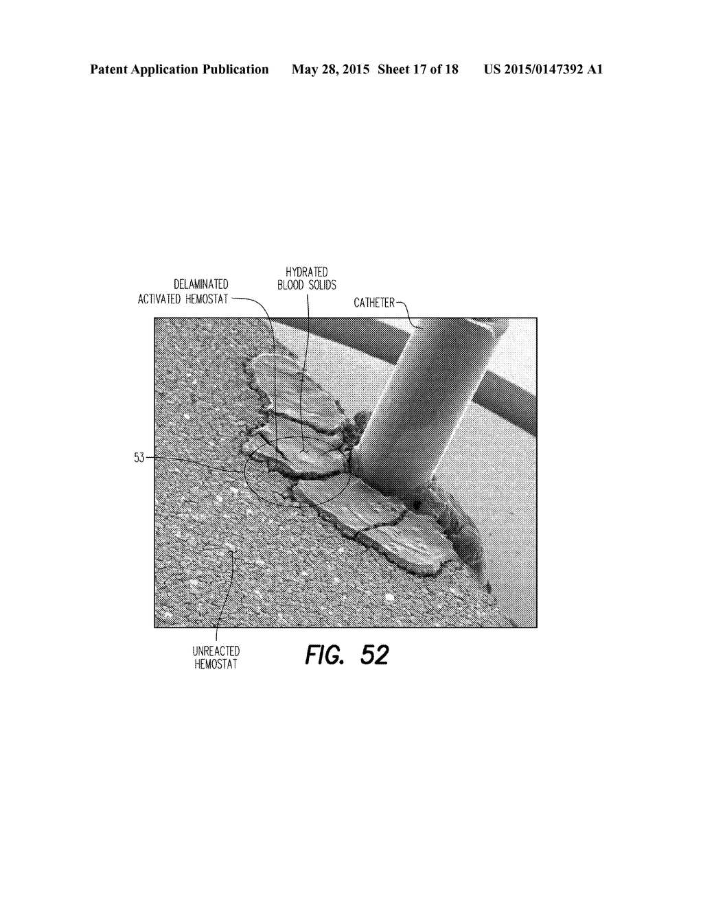 HEMOSTATIC DEVICE AND METHOD - diagram, schematic, and image 18