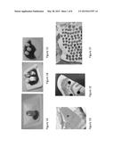 Biomatrix Hydrogels and Methods of Use Thereof diagram and image