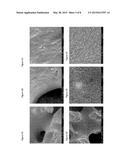 Biomatrix Hydrogels and Methods of Use Thereof diagram and image