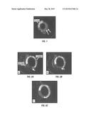 Intraocular Formulation diagram and image