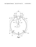 PROCESS FOR COMPLETE CLADDING OF METAL PARTS OF AIRCRAFT TURBOJETS, AND     COMPLETE PROTECTION TOOL FOR IMPLEMENTING THE PROCESS diagram and image