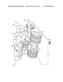 EXPANDABLE GRAIN TANK diagram and image