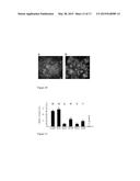 Methods for Treating or Preventing Brain Infections diagram and image