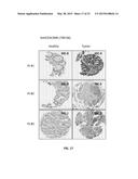 METHOD FOR DETECTING COLORECTAL CANCER diagram and image