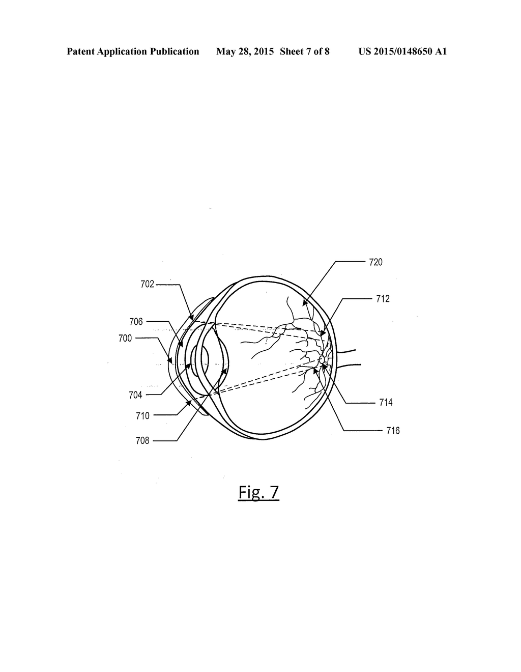 OPHTHALMIC LENS WITH RETINAL VASCULARIZATION MONITORING SYSTEM - diagram, schematic, and image 08