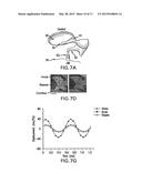 SYSTEM, METHOD AND COMPUTER-ACCESSIBLE MEDIUM FOR PROVIDING AND/OR     UTILIZING OPTICAL COHERENCE TOMOGRAPHIC VIBROGRAPHY diagram and image