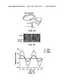 SYSTEM, METHOD AND COMPUTER-ACCESSIBLE MEDIUM FOR PROVIDING AND/OR     UTILIZING OPTICAL COHERENCE TOMOGRAPHIC VIBROGRAPHY diagram and image