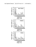 SYSTEM, METHOD AND COMPUTER-ACCESSIBLE MEDIUM FOR PROVIDING AND/OR     UTILIZING OPTICAL COHERENCE TOMOGRAPHIC VIBROGRAPHY diagram and image