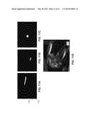 ULTRASONOGRAPHIC IMAGES PROCESSING diagram and image