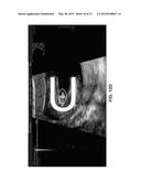 ULTRASONOGRAPHIC IMAGES PROCESSING diagram and image