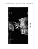 ULTRASONOGRAPHIC IMAGES PROCESSING diagram and image