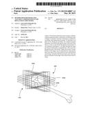 METHOD FOR FEMUR RESECTION ALIGNMENT APPROXIMATION IN HIP REPLACEMENT     PROCEDURES diagram and image