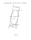 METHOD FOR FEMUR RESECTION ALIGNMENT APPROXIMATION IN HIP REPLACEMENT     PROCEDURES diagram and image