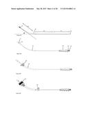 UTERINE MANIPULATOR diagram and image