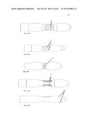 UTERINE MANIPULATOR diagram and image