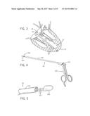 THORASCOPIC HEART VALVE REPAIR METHOD AND APPARATUS diagram and image