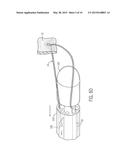 THORASCOPIC HEART VALVE REPAIR METHOD AND APPARATUS diagram and image