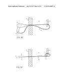 THORASCOPIC HEART VALVE REPAIR METHOD AND APPARATUS diagram and image