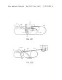 THORASCOPIC HEART VALVE REPAIR METHOD AND APPARATUS diagram and image