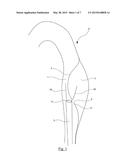 CUTTING DEVICE FOR ENDOVASCULAR SURGERY diagram and image